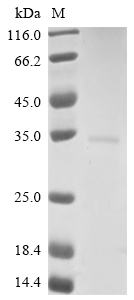 Virus M protein