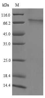Human WHSC1L1 protein