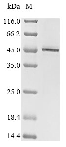 Human AADAC protein