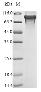 Human IKBKB protein