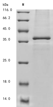Human DNASE1L3 protein
