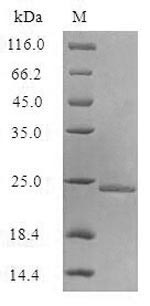 E. coli aqpz protein