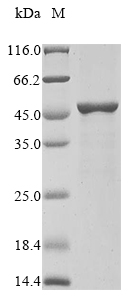 Human AADAC protein