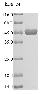 Human NPR1 protein