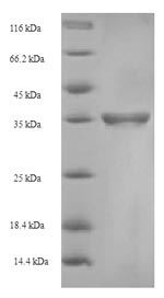 Human CLEC4C protein