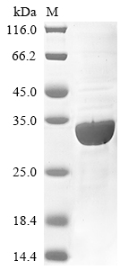 Human PITPNM3 protein