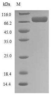 Human EPHA3 protein