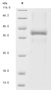 Human FCER2 protein