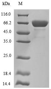 Human Mesothelin protein