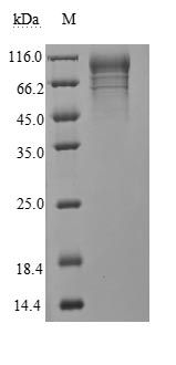 Human 2019-nCOV-N protein