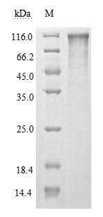 Human 2019-nCOV-S protein
