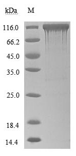 Human Angiotensin-converting enzyme 2 protein