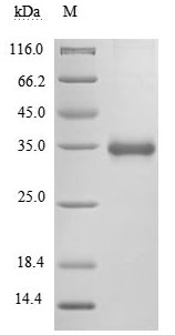 Human Novel Coronavirus Spike glycoprotein(S) protein