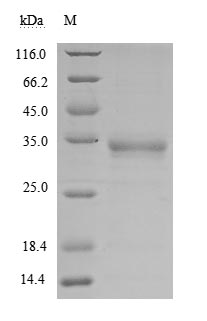 Human Novel Coronavirus Spike glycoprotein(S) protein