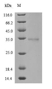 Human Novel Coronavirus Spike glycoprotein(S) protein