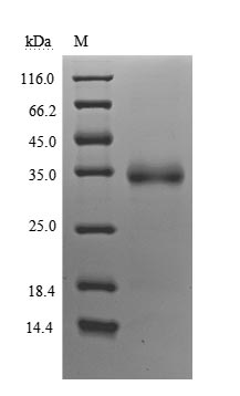 Human Novel Coronavirus Spike glycoprotein(S) protein