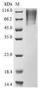 Human SARS coronavirus Spike glycoprotein protein