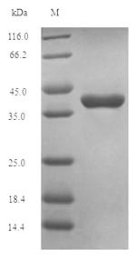 Human OSM protein