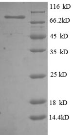 Human NT5E protein