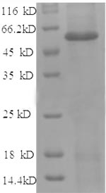 Human ANGPT2 protein