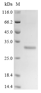 Human FGF-21 protein