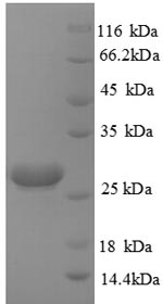 Human HPRT1 protein