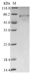 Human DEK protein