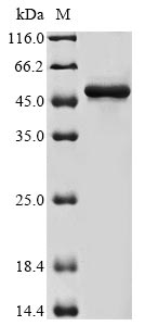 Human ACTR3 protein