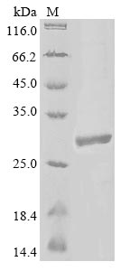 Human PARP14 protein