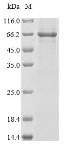 Lassa virus Nucleo protein