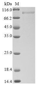 Human TIMD4 protein