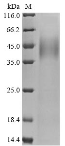 Human PARP14 protein