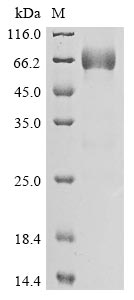 Human PARP14 protein