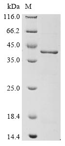 Human ANXA1 protein