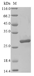 Human PARP14 protein