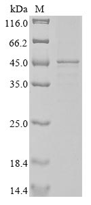 Human ACTB protein
