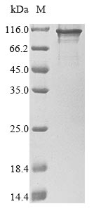 Human KAT14 protein
