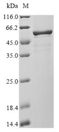 Human coronavirus 229E Nucleo protein