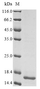 Human coronavirus 229E Spike glycoprotein protein