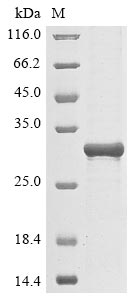 Human PARP14 protein