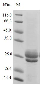 E. coli aqpZ protein
