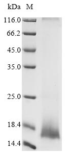 Human coronavirus NL63 Envelope small membrane protein