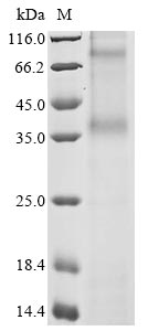 Human CCR8 protein