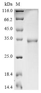 Bat coronavirus 133/2005 Spike glycoprotein protein