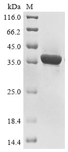 Human DNASE1L3 protein