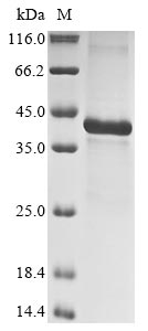 Human IGFBP5 protein