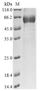 Mouse Sost protein