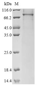 Human FSHR protein