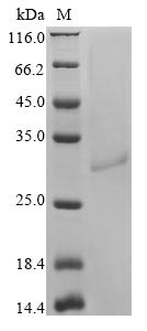 Rat Sost protein