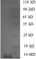 Human CCL5 protein